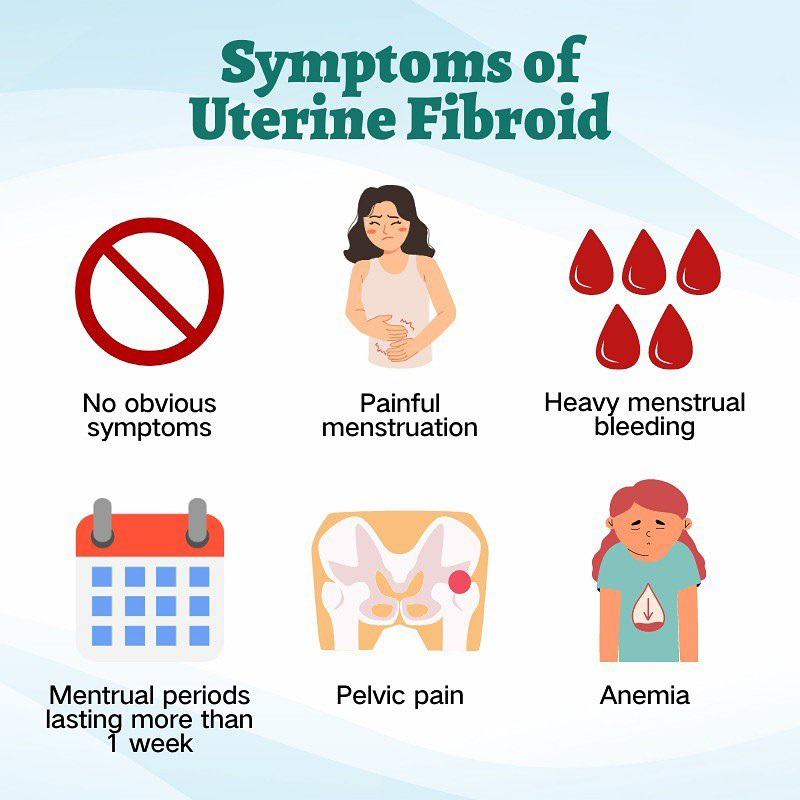 Uterine Fibroid Embolisation